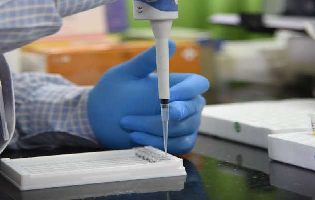 Serology Tests at Biocheck Pathology